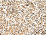 Anti-Human GEMIN4 Antibody - ABMIUM