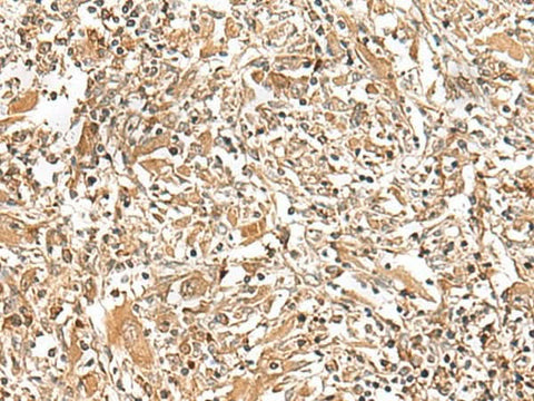 Anti-Human GEMIN4 Antibody - ABMIUM