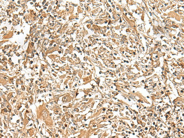 Anti-Human GEMIN4 Antibody - ABMIUM