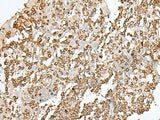 Immunohistochemistry of paraffin-embedded Human tonsil tissue using SEPT1 Polyclonal Antibody at dilution of 1:50(×200)