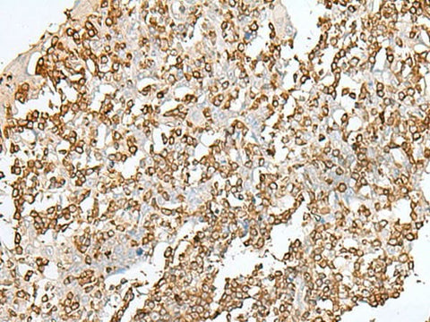 Immunohistochemistry of paraffin-embedded Human tonsil tissue using SEPT1 Polyclonal Antibody at dilution of 1:50(×200)