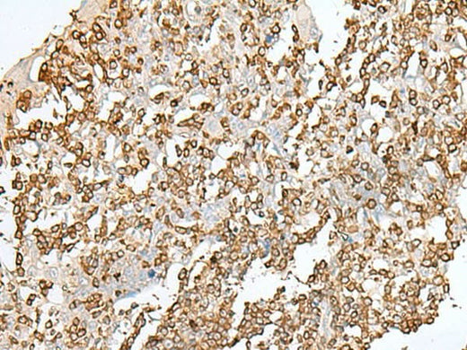 Immunohistochemistry of paraffin-embedded Human tonsil tissue using SEPT1 Polyclonal Antibody at dilution of 1:50(×200)