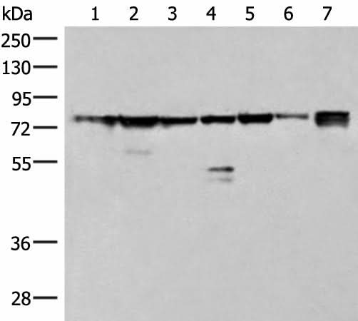 Western blot analysis of 231 K562 TM4 cell Mouse kidney tissue Mouse liver tissue Mouse brain tissue Hela cell lysates using THNSL1 Polyclonal Antibody at dilution of 1:500