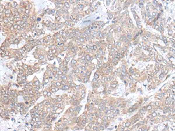 Anti-Human PLGLB2 Antibody