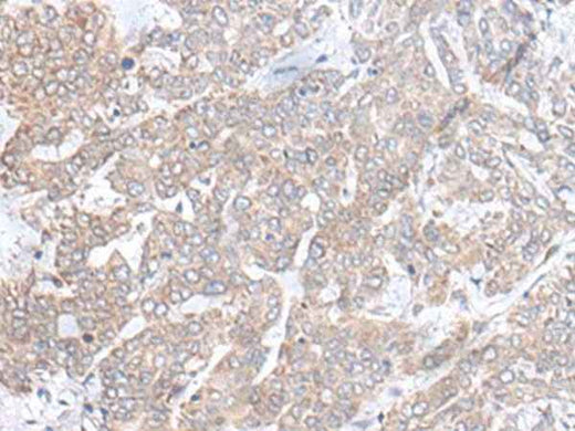Anti-Human PLGLB2 Antibody