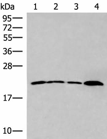 Western blot analysis of 231 cell Human breast cancer tissue Raji cell Human fetal liver tissue lysates using IFNA5 Polyclonal Antibody at dilution of 1:400