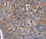 Anti-Human/Mouse/Rat ARRB1 Antibody - ABMIUM