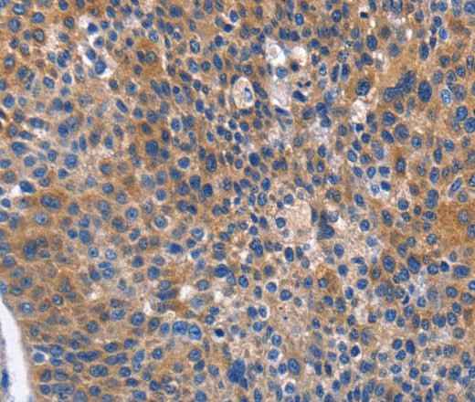Anti-Human/Mouse/Rat ARRB1 Antibody