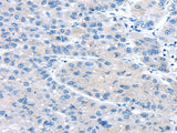 Anti-Human/Mouse/Rat UCP2 Antibody - ABMIUM