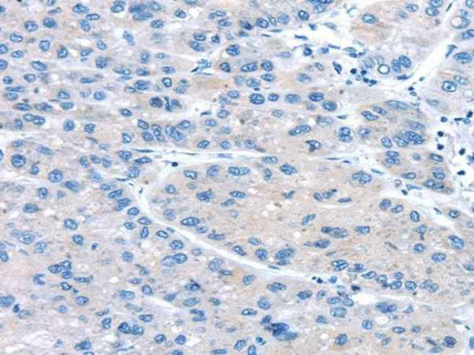Anti-Human/Mouse/Rat UCP2 Antibody