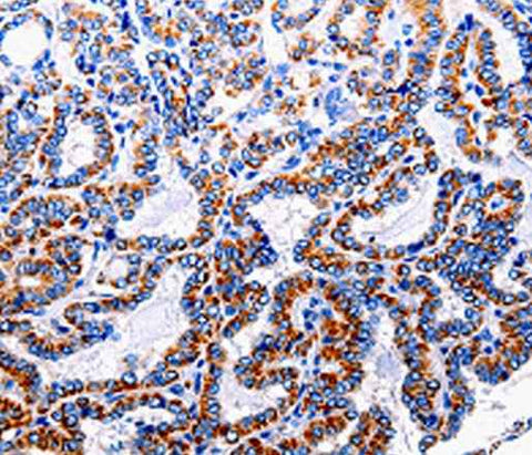 Anti-Human NFκB-p105 Antibody