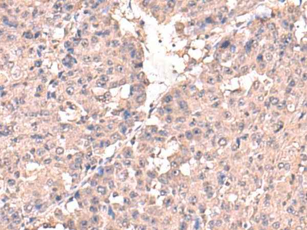 Anti-Human/Mouse/Rat HPN Antibody