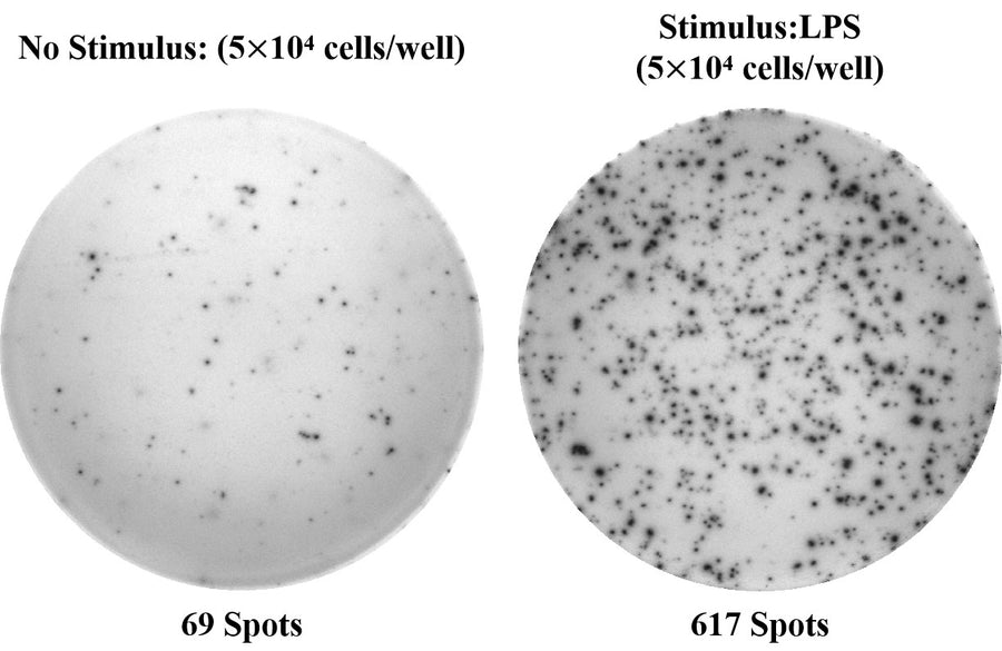 Human IL-10 (Interleukin 10) ELISPOT Kit - ABMIUM