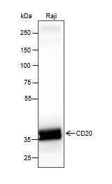 Anti-Human/Rat/Mouse CD20 Antibody [A165]