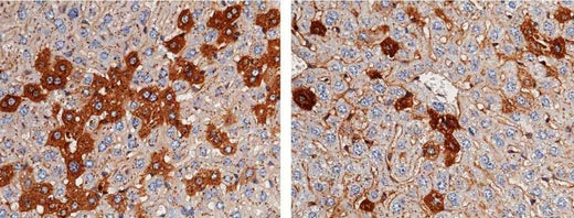 Anti-Mouse AHSG Antibody [B405] - ABMIUM