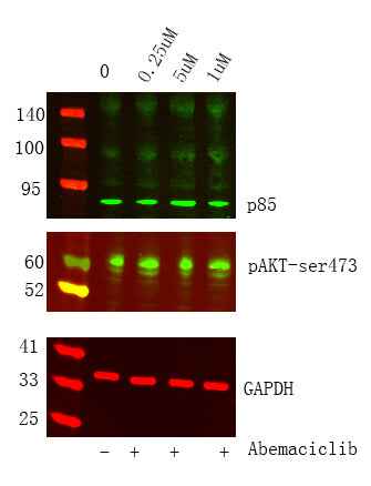Anti-Human/Mouse/Rat PI3-Kinase p85 α Antibody [B867] - ABMIUM