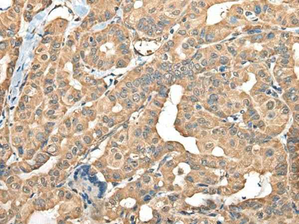 Anti-Human/Mouse/Rat FAM110B Antibody