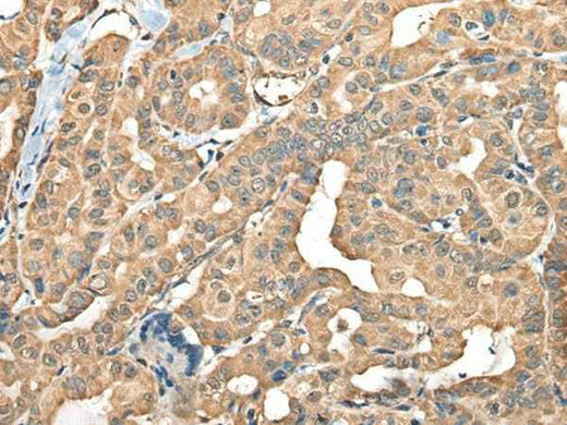 Anti-Human/Mouse/Rat FAM110B Antibody