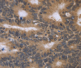 Anti-Human/Mouse/Rat FGFR1OP2 Antibody - ABMIUM