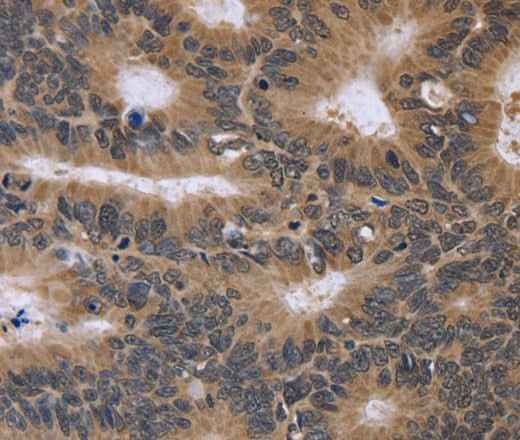 Anti-Human/Mouse/Rat FGFR1OP2 Antibody