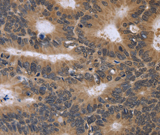 Anti-Human/Mouse/Rat FGFR1OP2 Antibody - ABMIUM