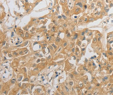 Anti-Human/Mouse/Rat HCRTR2 Antibody - ABMIUM