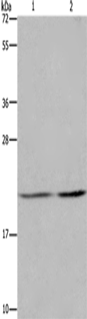 Anti-Human/Mouse ASF1A Antibody - ABMIUM