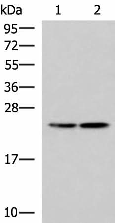 Western blot analysis of A549 and A172 cell lysates using RGS2 Polyclonal Antibody at dilution of 1:1350