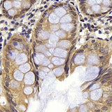 Immunohistochemistry analysis of paraffin-embedded human colon using BAD Polyclonal Antibody at dilution of 1:300.