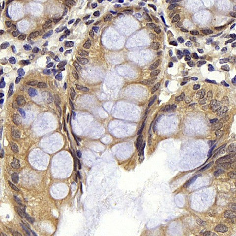 Immunohistochemistry analysis of paraffin-embedded human colon using BAD Polyclonal Antibody at dilution of 1:300.
