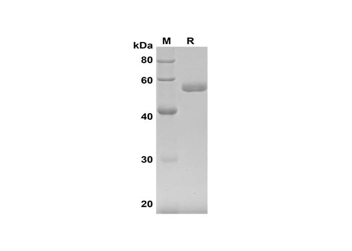 SDS-PAGE analysis of Human IFN-β proteins, 2 μg/lane of Recombinant Human IFN-β proteins was resolved with SDS-PAGE under reducing conditions, showing bands at 55 kDa.