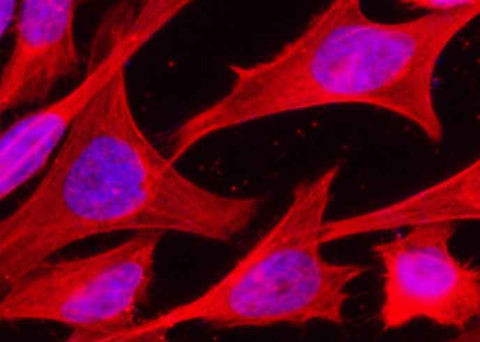 Anti-Human HSPA1A Antibody [B333] - ABMIUM