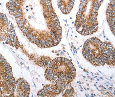 Anti-Human/Mouse/Rat HCRTR1 Antibody