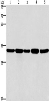 Anti-Human/Mouse E2F6 Antibody - ABMIUM