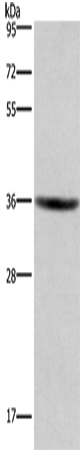 Anti-Human GPR171 Antibody - ABMIUM