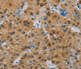 Anti-Human CD272 Antibody - ABMIUM