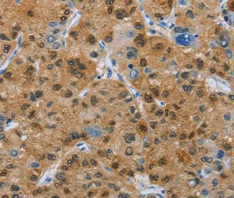 Anti-Human CD272 Antibody