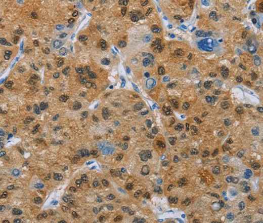 Anti-Human CD272 Antibody