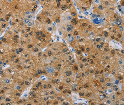 Anti-Human CD272 Antibody - ABMIUM
