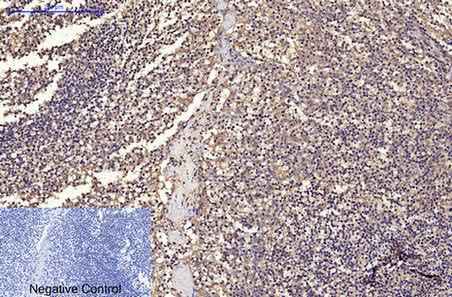 Anti-Human/Mouse/Rat CD68 Antibody [2K6]