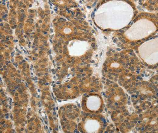 Anti-Human/Mouse RARA Antibody