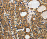Anti-Human/Mouse RARA Antibody - ABMIUM