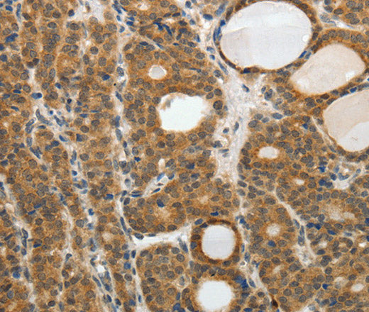 Anti-Human/Mouse RARA Antibody - ABMIUM