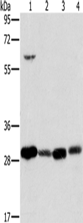 Anti-Human/Mouse MRPL28 Antibody - ABMIUM