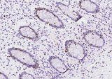 Anti-Human MKI67 Antibody [A1005] - ABMIUM