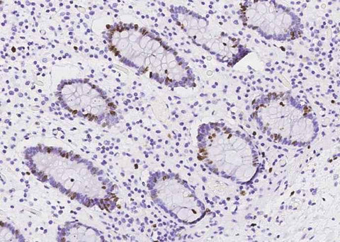 Anti-Human MKI67 Antibody [A1005] - ABMIUM