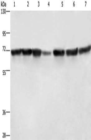 Western blot analysis of Hela cells HT29 cells human fetal liver tissue Human testis tissue 231 cells K562 cells human bladder transitional cell carcinoma tissue using LMNB1 Polyclonal Antibody at dilution of 1:750