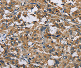 Anti-Human/Mouse GAB1 Antibody - ABMIUM