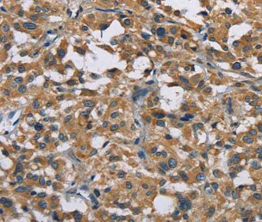 Anti-Human/Mouse GAB1 Antibody