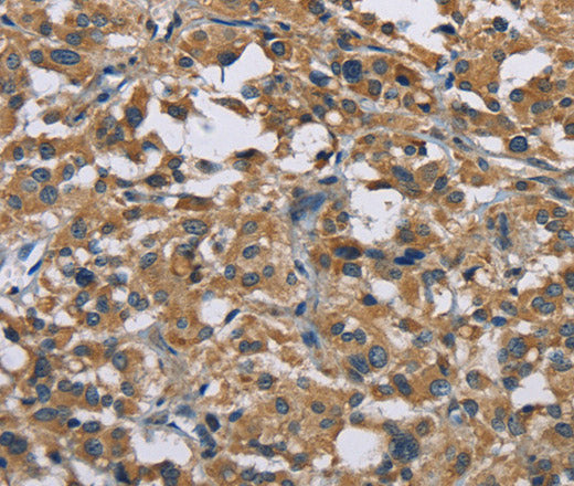 Anti-Human/Mouse GAB1 Antibody - ABMIUM